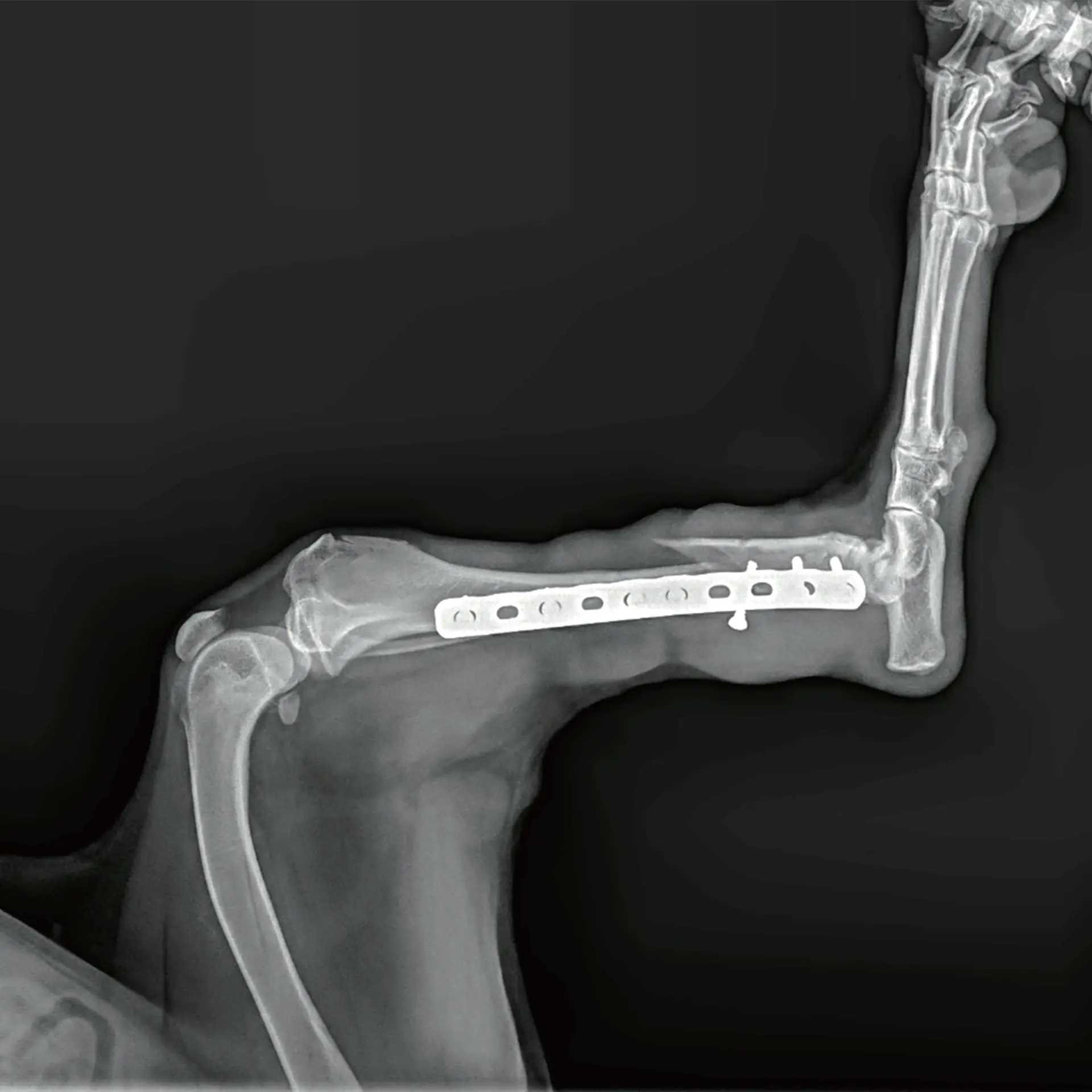 Kırık sonrası post-operatif inceleme