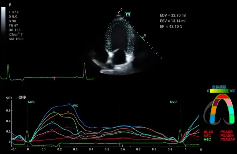 TT QA (Doku Takibi Kantitatif Analizi)