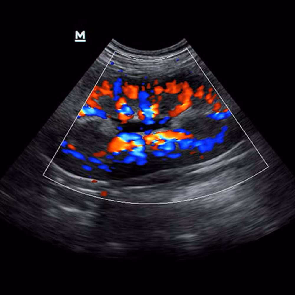 Color Doppler, Böbrek, Köpek