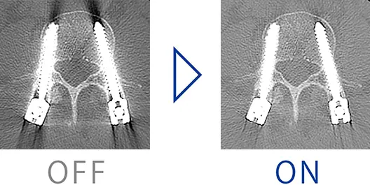 Supria 32, Yüksek İşlev ile buluşuyor