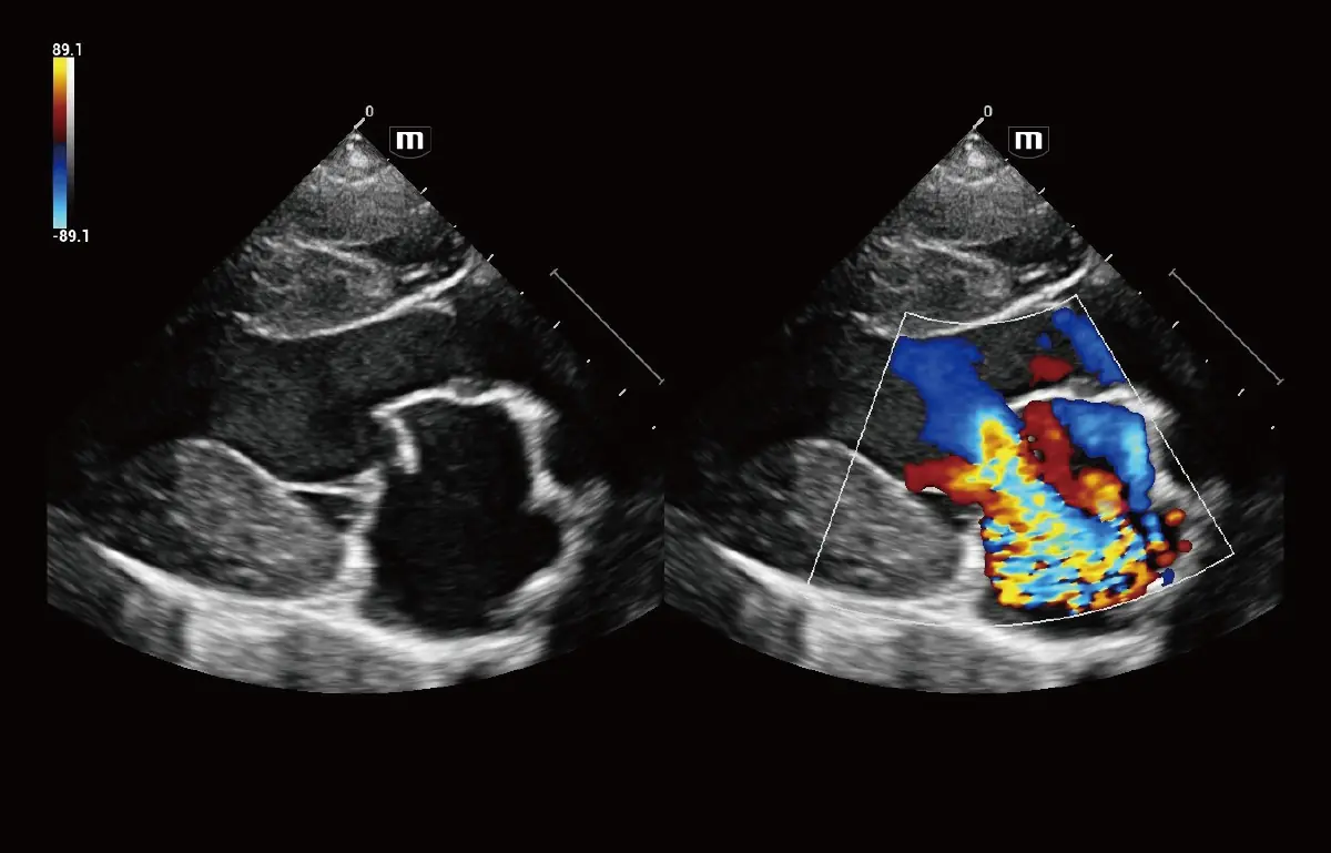 Köpek Mitral Yetmezliği