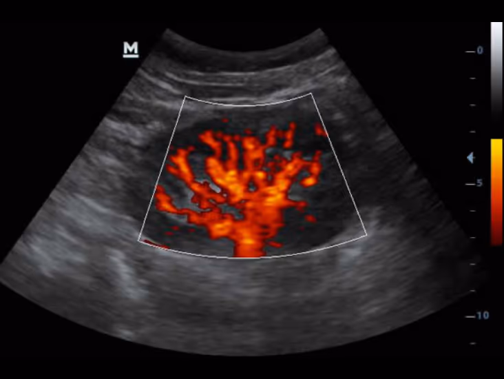 Power Doppler, Böbrek, Köpek