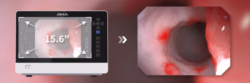 Yüksek Çözünürlüklü Ekran