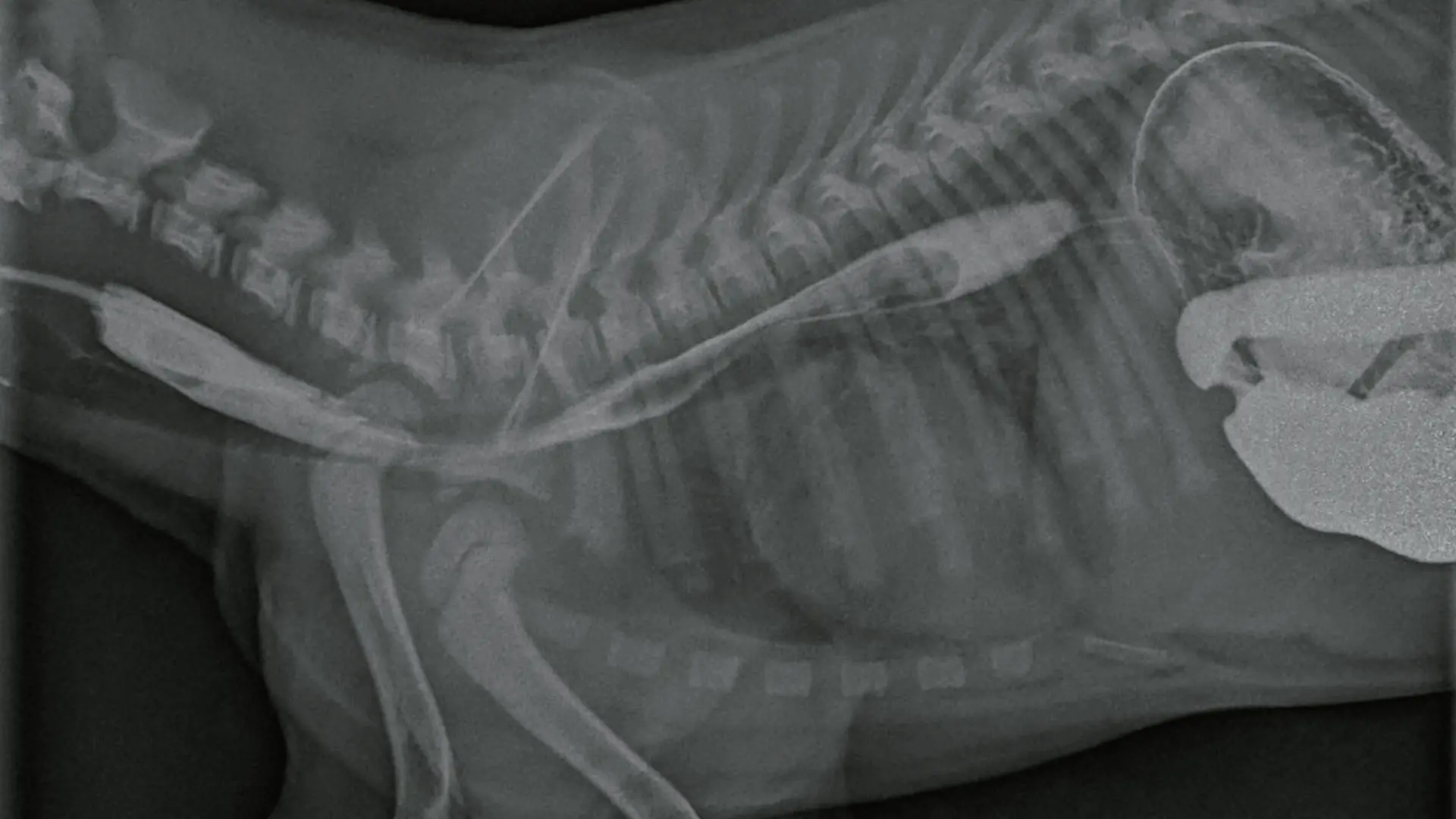 Oral kontrast maddesi