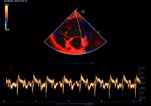 Köpek Kalbinin TVD'si
