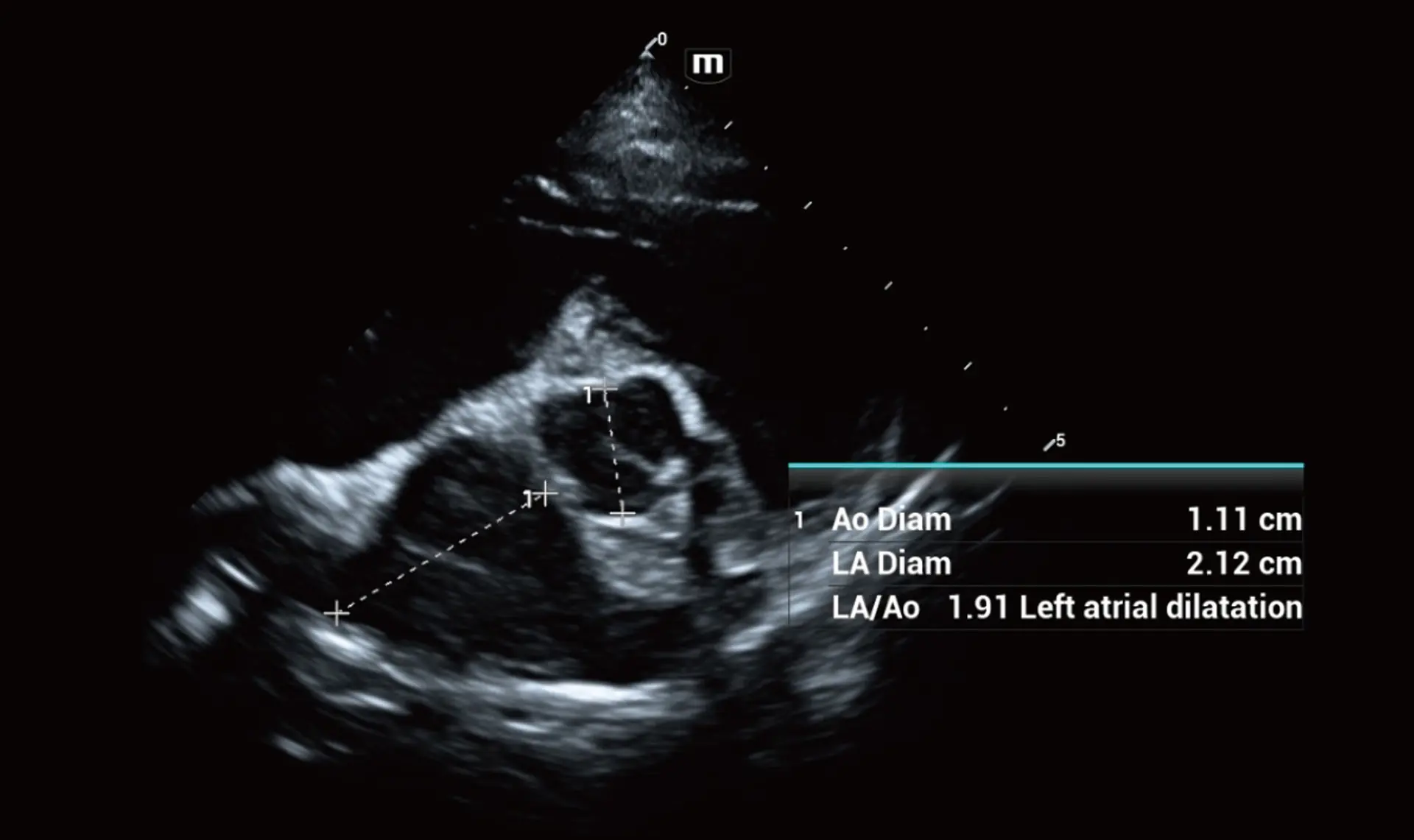 Potansiyel veya şüpheli klinik durumları ölçümlere dayalı belirtme