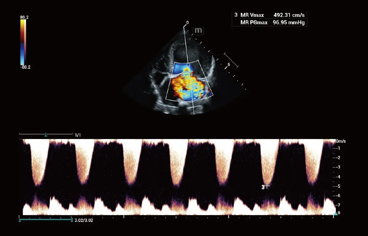 Köpek Mitral Yetmezliği CW