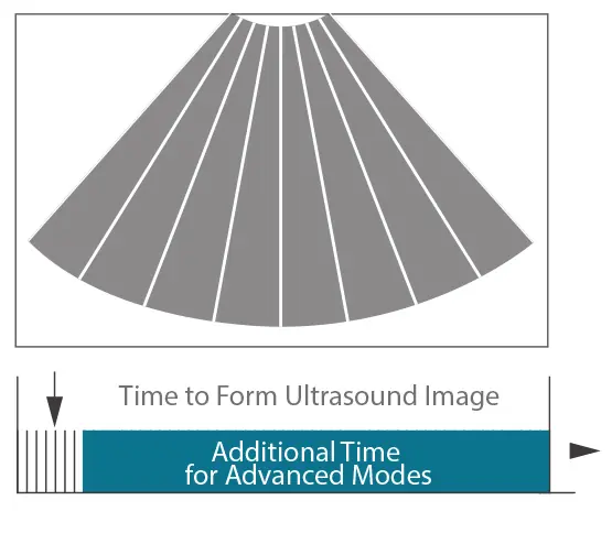 ZONE Sonografi™ Teknolojisi +