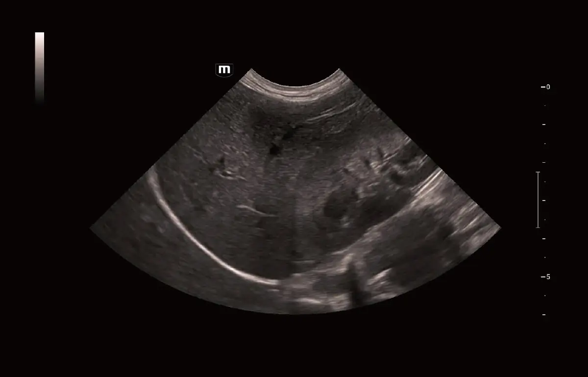 Köpek Karaciğeri ve Böbrek Düzlemi