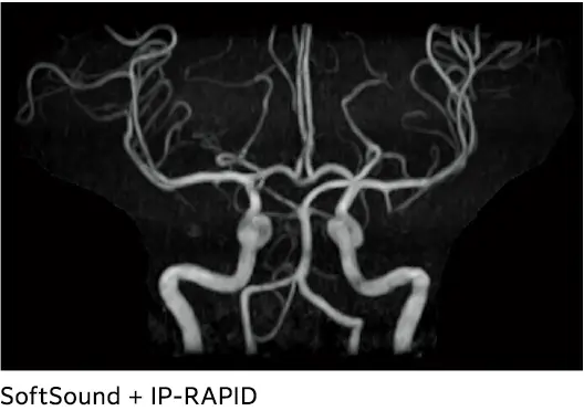 *2 Görüntüleme koşullarına bağlı olarak