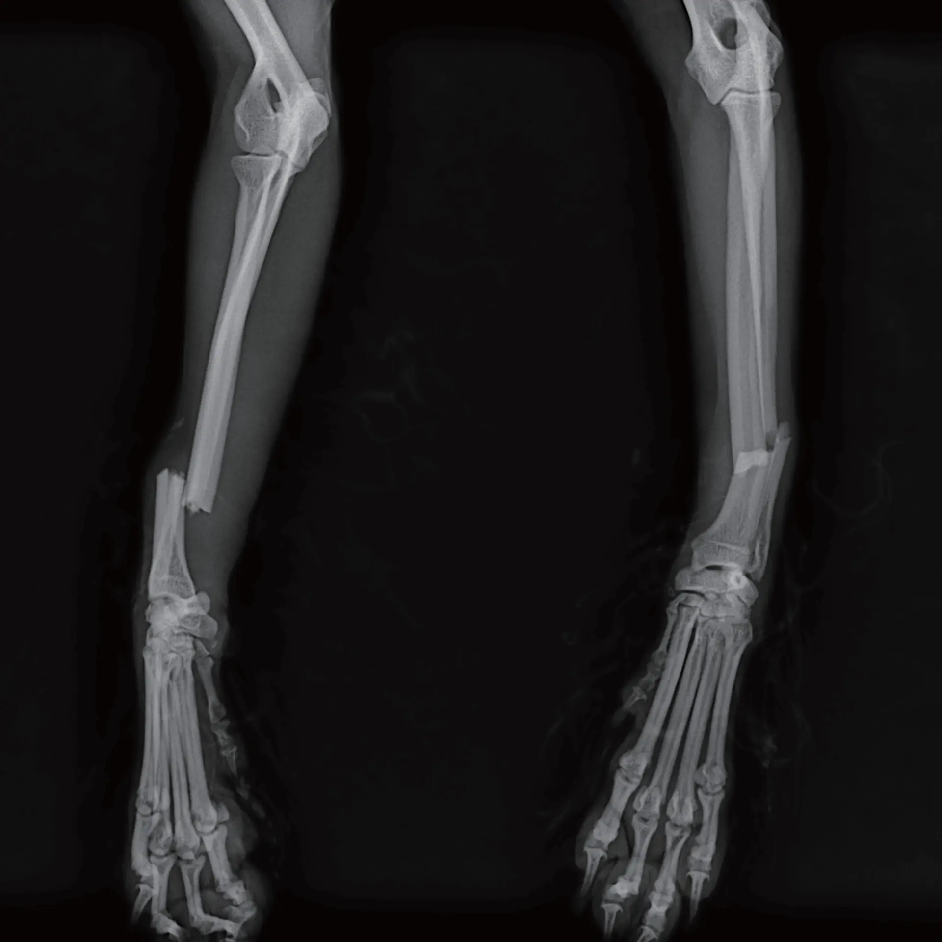 Ortopedik Görüntüleme