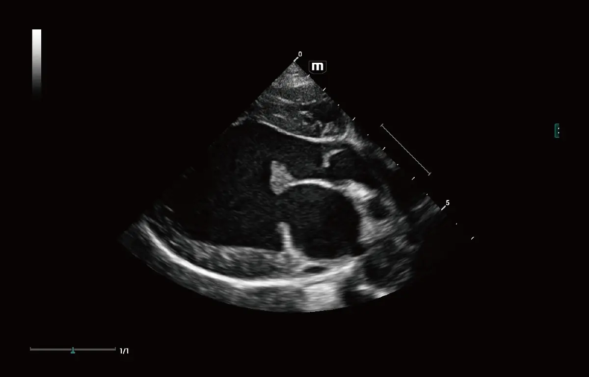Köpeklerde Miksomatoz Mitral Kapak Hastalığı (MMVD)