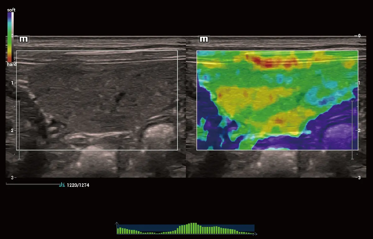 Köpek Dalağı Doğal Dokunuş Elastografisi