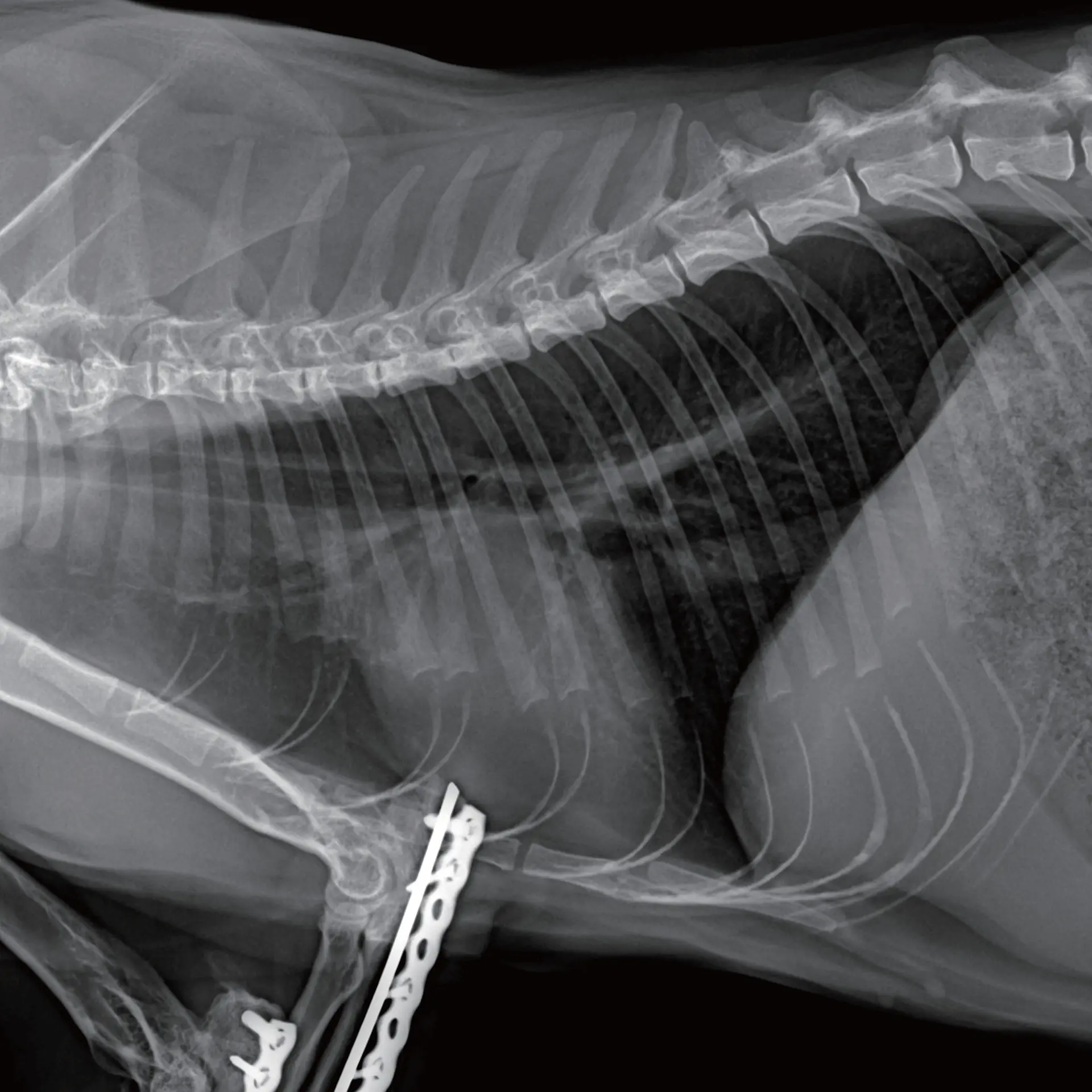 Akciğer Görüntüleme