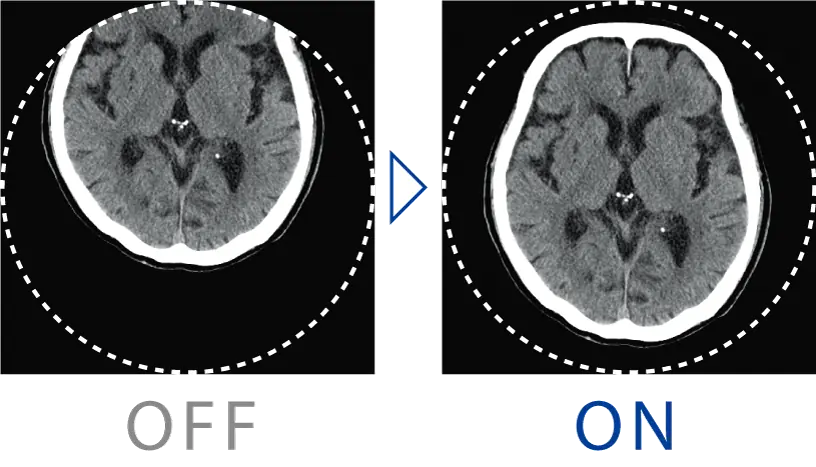 Tam FOV veri toplama