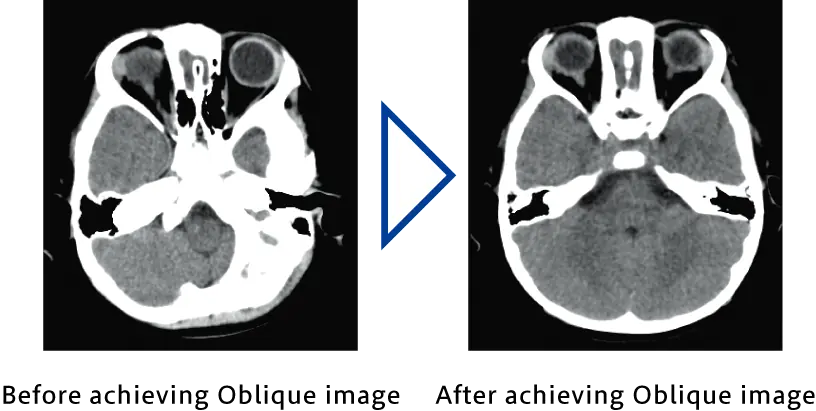 Supria 32, Yüksek Performans ile buluşuyor