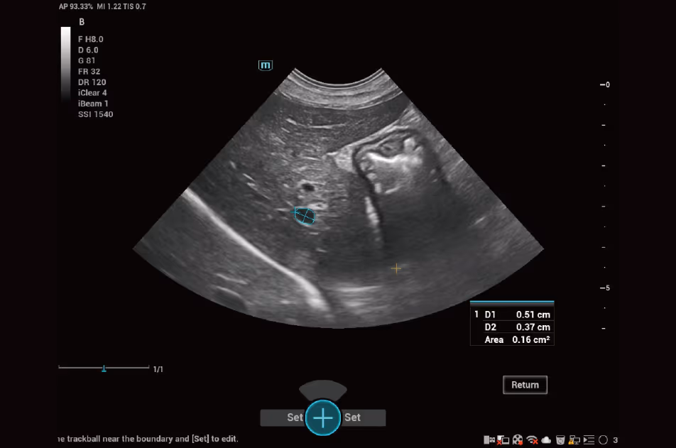 Smart Calc (Akıllı Hesap Makinesi)