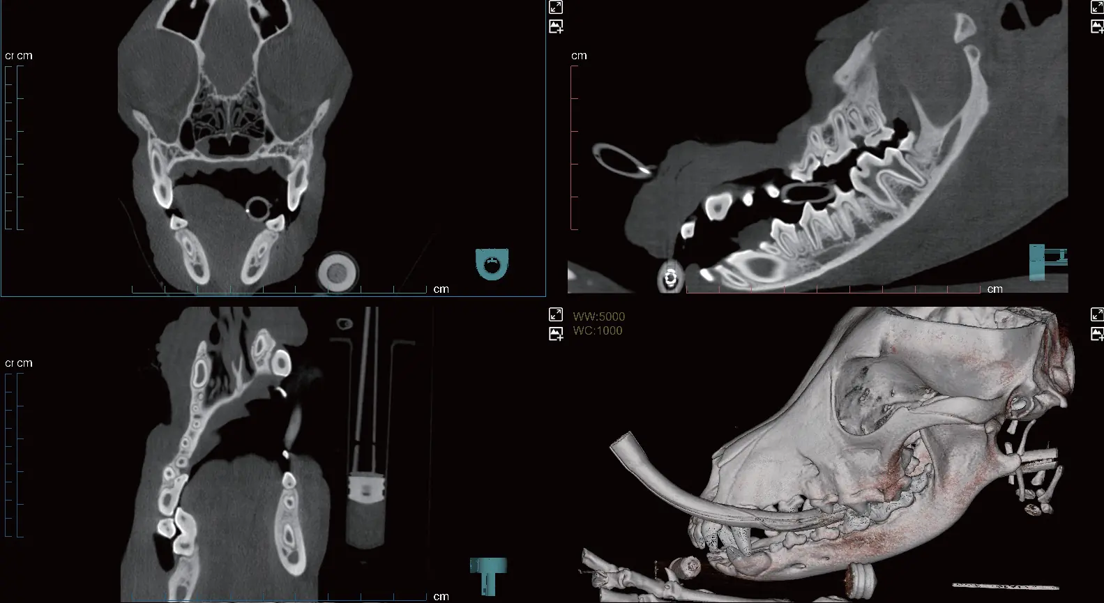 Otomatik Üç Fazlı Tarama
