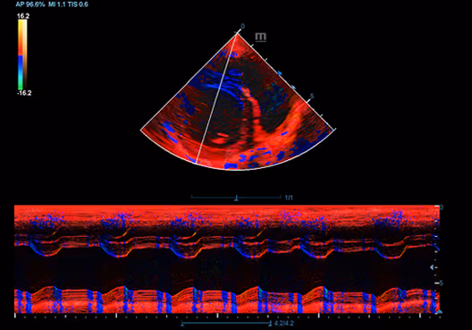 Köpek Kalbinin TVD'si
