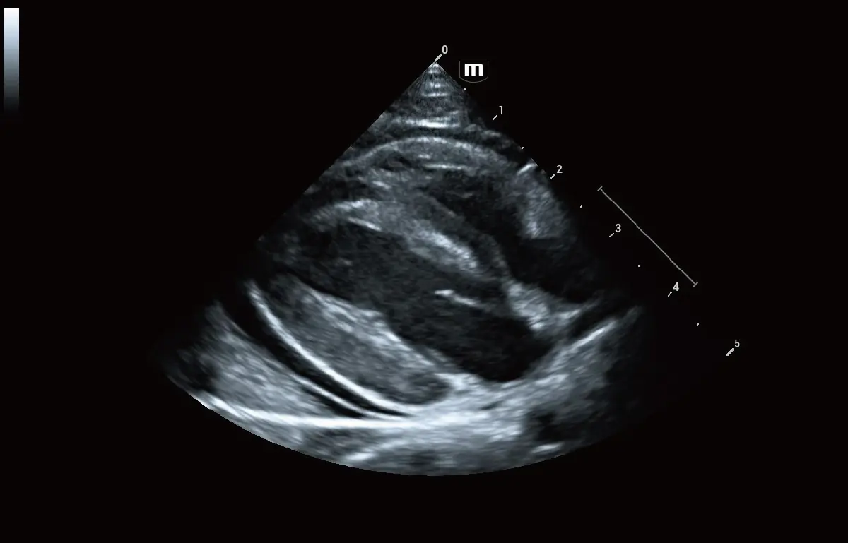 Kedilerde Perikardiyal Efüzyon